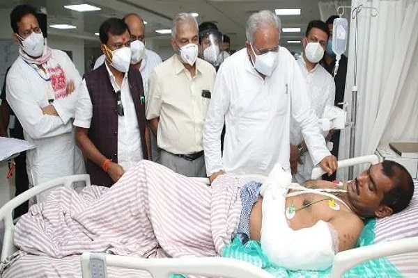 मुख्यमंत्री भूपेश बघेल अस्पताल पहुंचकर घायल जवानों से मिले