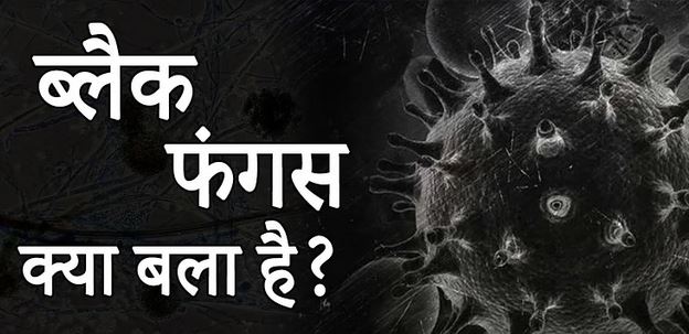 क्या एक साथ हो सकता है कोरोना और ब्लैक फंगल इंफेक्शन, यहां जानें हर सवाल का जवाब