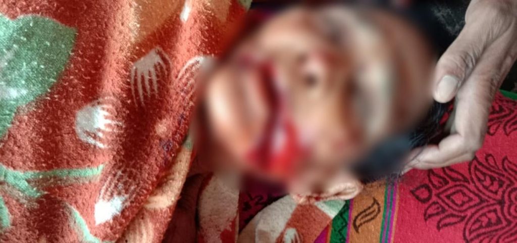 मां को दी खौफनाक सजा: जिसने जन्म दिया, जिसने बोलना सिखाया, उसी मां के बेरहम बेटे ने काट दी ज़बान