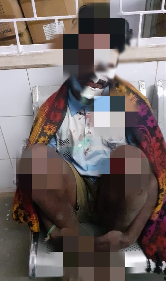 कलेक्टर एवं एसपी ने सड़क हादसे में घायल मरीज को एम्बुलेंस बुलाकर पहुंचाया अस्पताल