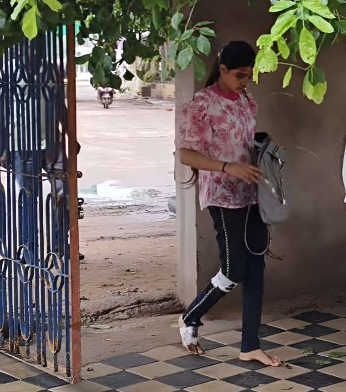 दुर्घटना के बाद लगे टांके फिर भी परीक्षा देने पहुंची युवती ...