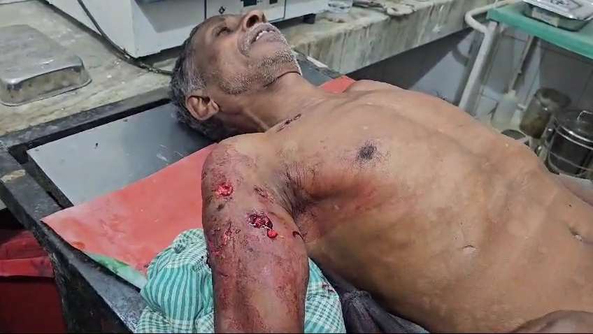 भालू ने एक व्यक्ति पर किया हमला...